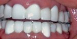 Sam Dental - After dental work
